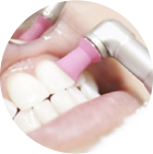 専門の機械・器具による歯の清掃